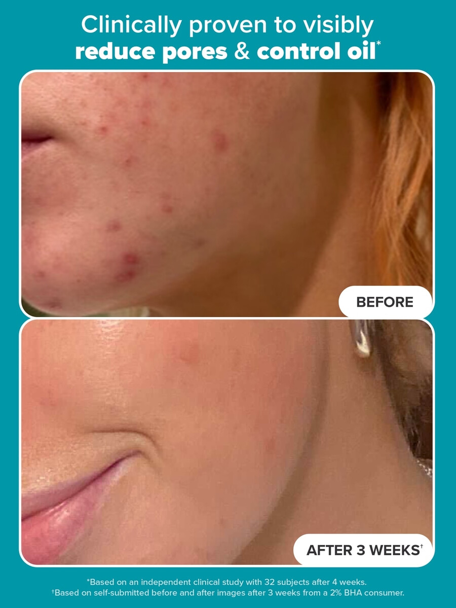 2 bha peeling-toner-pads