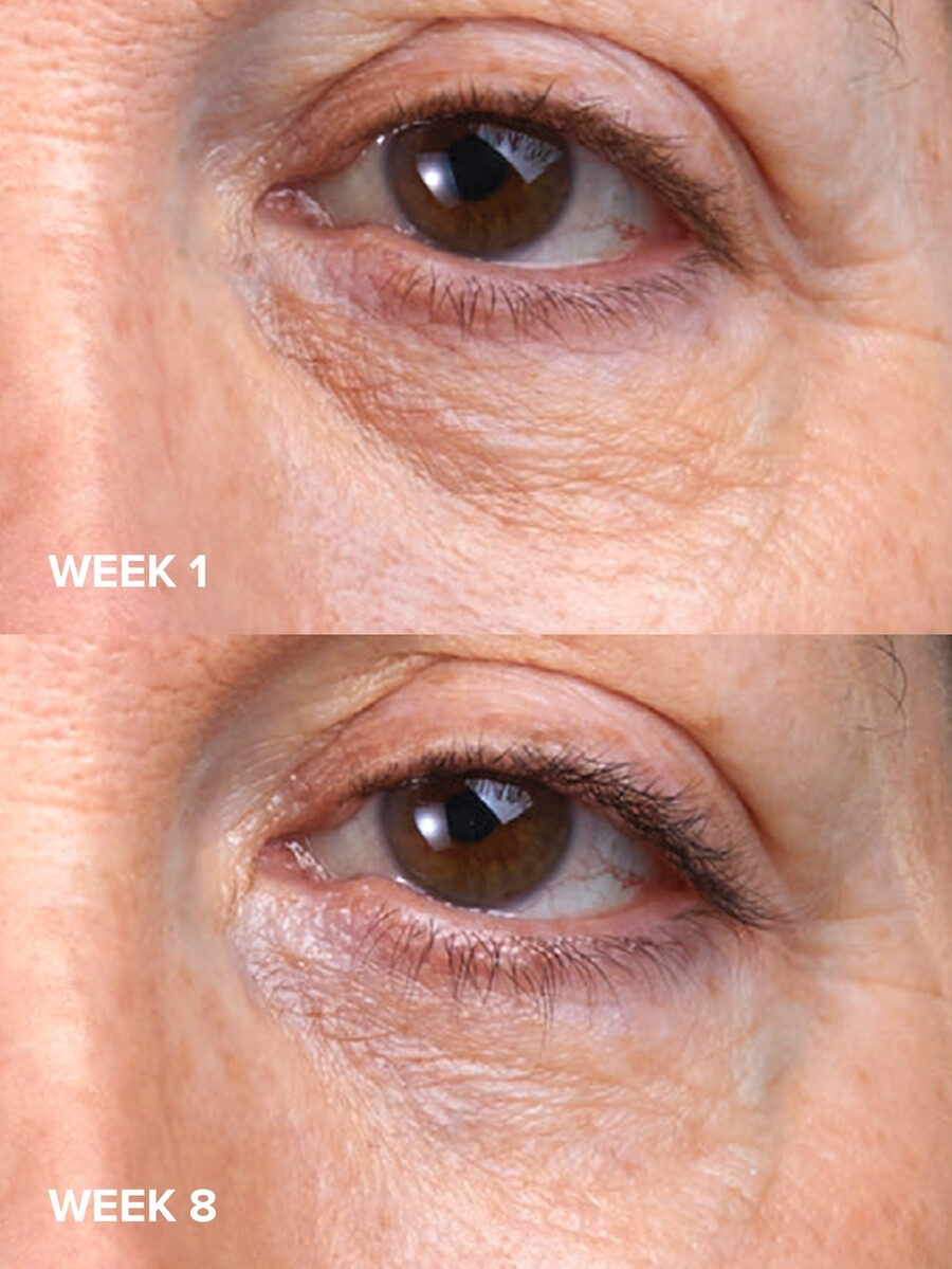 c5 super boost augencreme